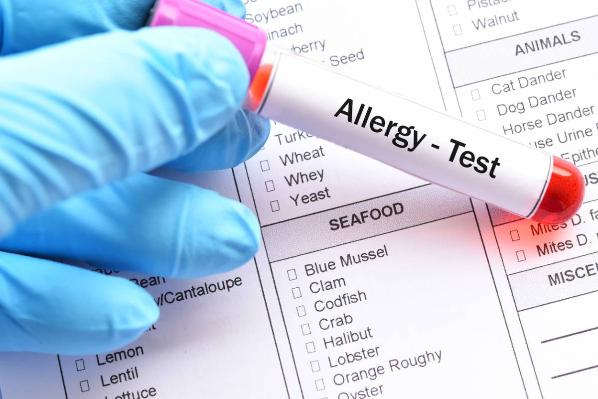Image of Are allergy tests accurate