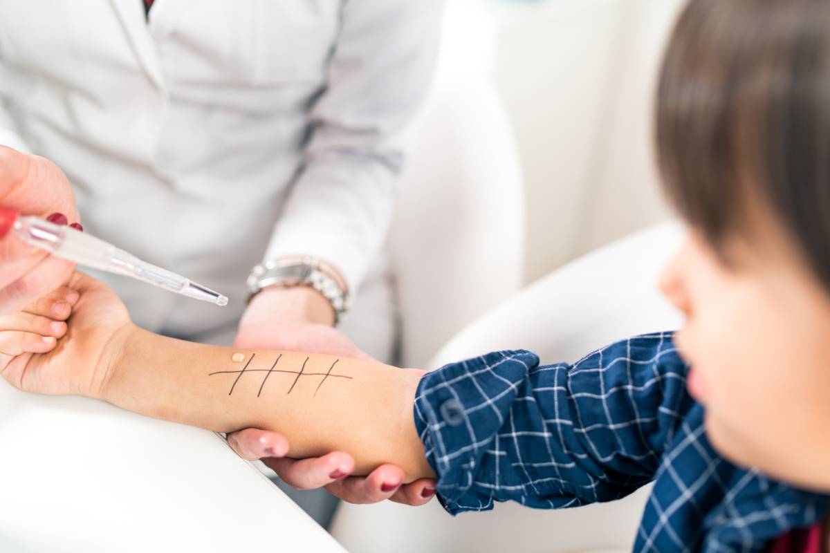 Concept image of kid having allergy testing